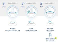 衡水同瑞眼科:微创全飞秒精准 4.0 - VISULYZE,让近视患者重获清晰视界